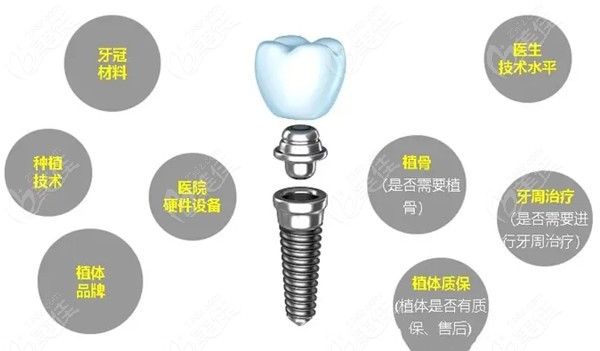 四川种植牙集采最新动态，绿意启程，追寻内心宁静的微笑
