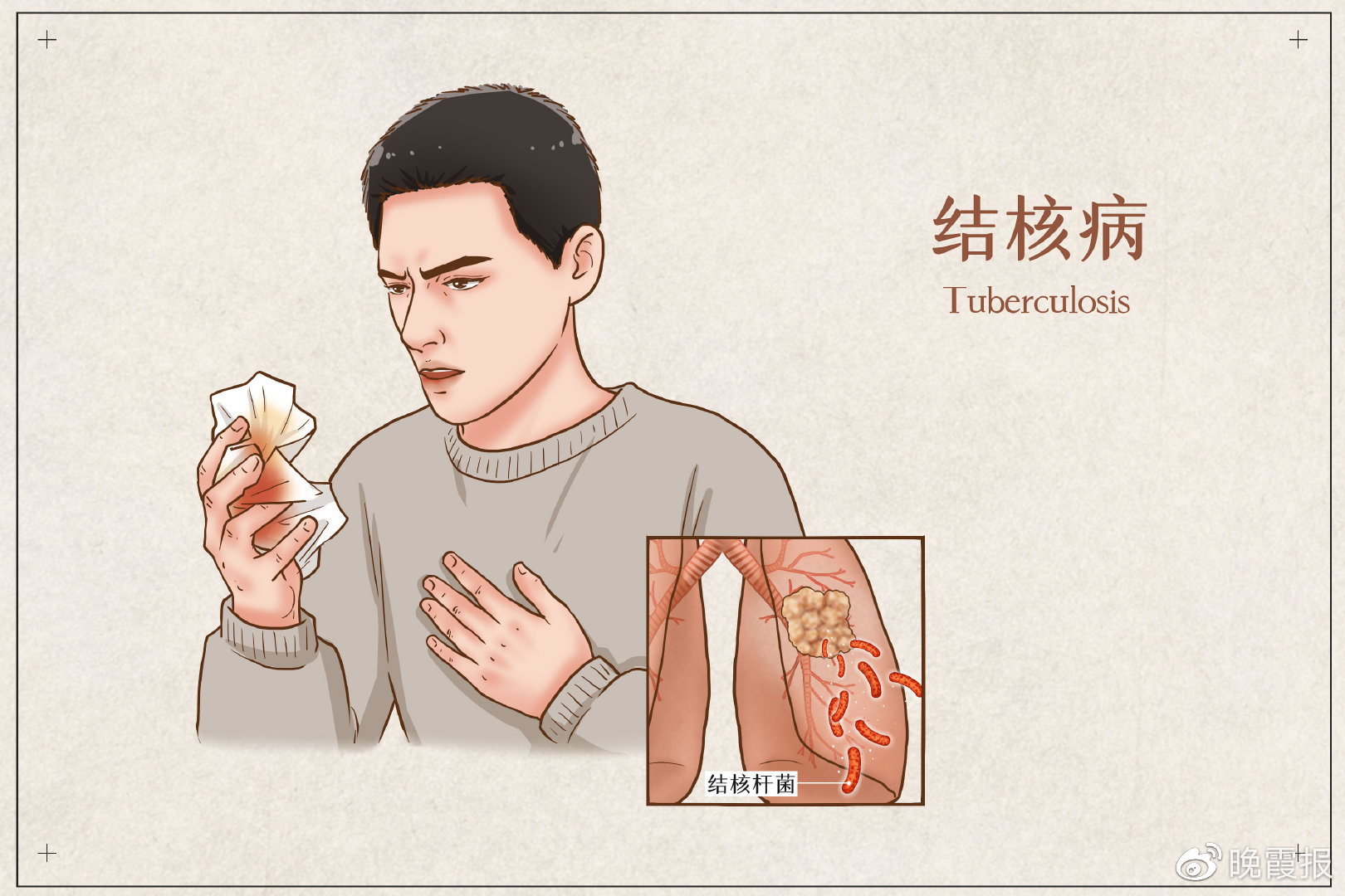 肺结核最新治疗，小巷深处的治愈之道